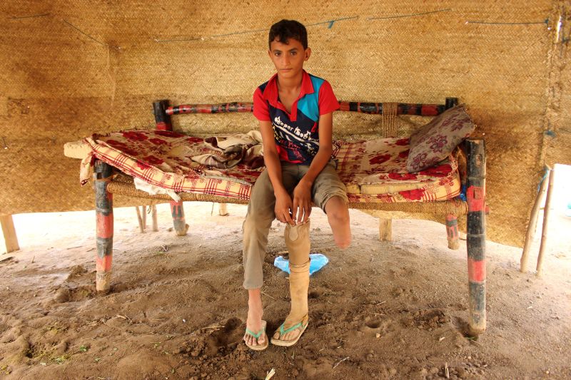 Air strikes maim, scar Yemen's children