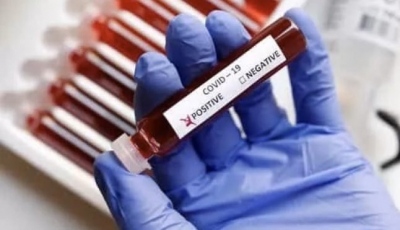7 BSF men among 11 test positive in Tripura after gap of 48 hrs