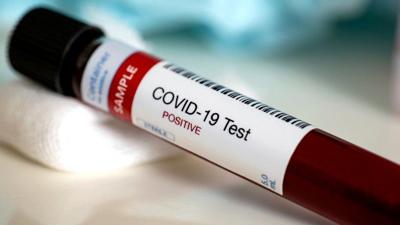 64 kids hospitalised in NY with disease possibly related to COVID-19