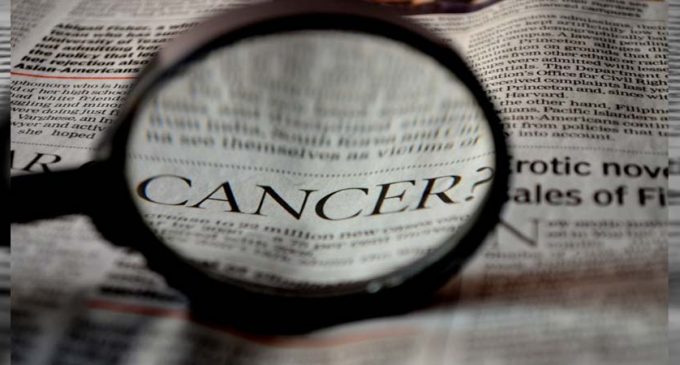 New cancer treatment prevents hair loss from chemotherapy