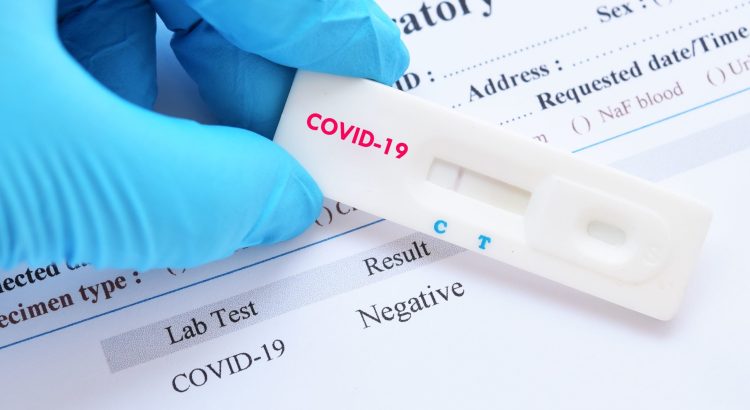 Researchers develop fast antibody blood test for Covid-19