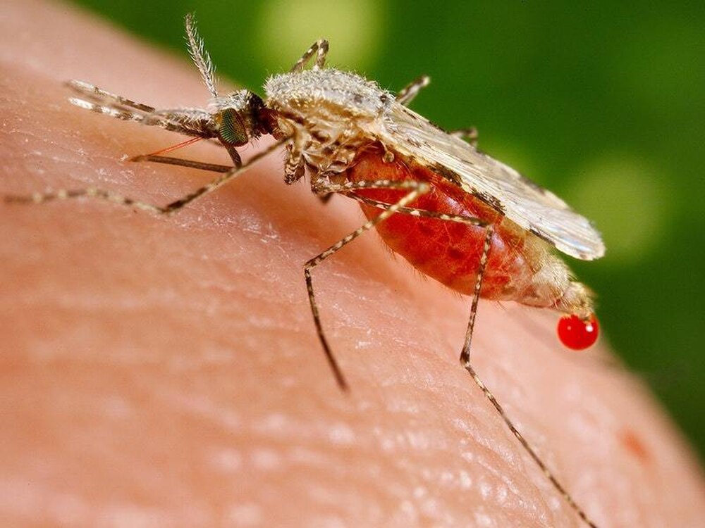 Malaria linked to 30% higher risk of heart failure