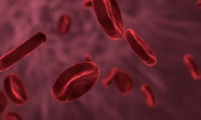 This blood test may predict onset of tuberculosis