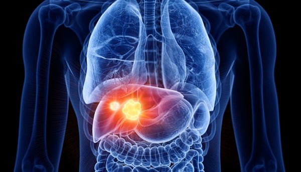 Liver cancer rates in older adults on the rise: Study