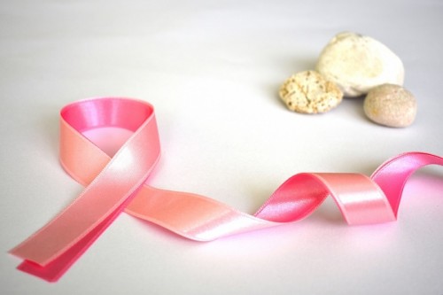 Galactorrhea affects 24% women, not linked to breast cancer