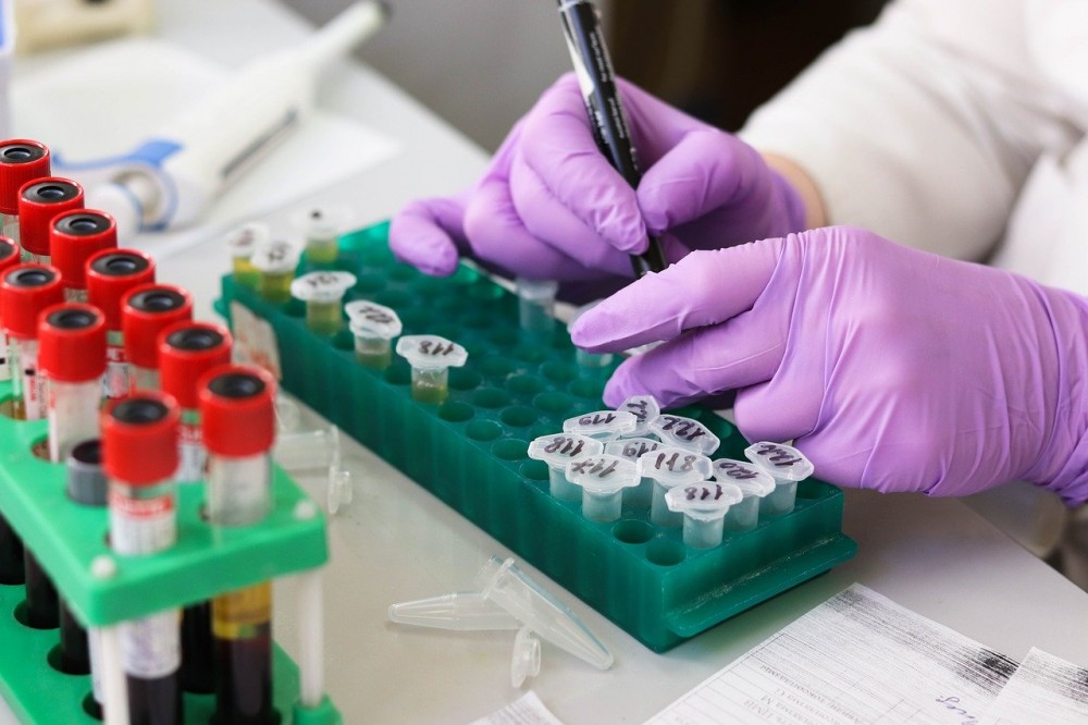 Department of Health and Family Welfare Nagaland has permitted private hospitals and laboratories in the state for testing of COVID-19 through TrueNat and Rapid Antigen Detection Test subject to fulfillment of ICMR criteria. (Image by Belova59 from Pixabay)