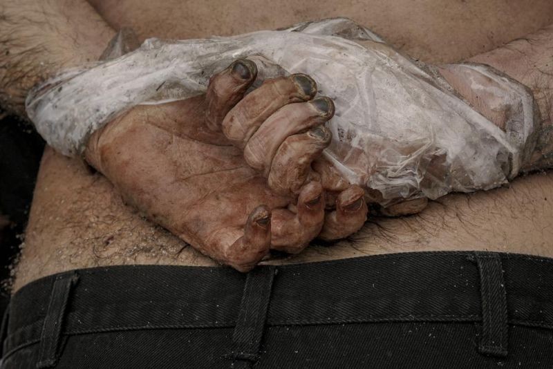 A lifeless body of A lifeless body of a man with his hands tied behind his back lies on the ground in Bucha, Ukraine, Sunday, April 3, 2022. Associated Press journalists in Bucha, a small city northwest of Kyiv, saw the bodies of at least nine people in civilian clothes who appeared to have been killed at close range. At least two had their hands tied behind their backs. (AP Photo)a man with his hands tied behind his back lies on the ground in Bucha, Ukraine, Sunday, April 3, 2022. Associated Press journalists in Bucha, a small city northwest of Kyiv, saw the bodies of at least nine people in civilian clothes who appeared to have been killed at close range. At least two had their hands tied behind their backs. (AP Photo/Vadim Ghirda)