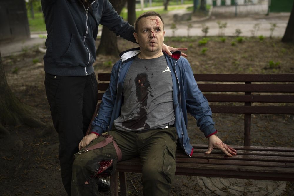 Kharkiv : A man injured from shrapnel waits for emergency workers after a Russian bombardment in Kharkiv, Ukraine, Wednesday, April 27, 2022. AP/PTI