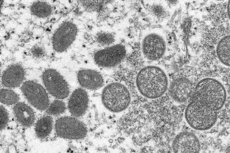 This 2003 electron microscope image made available by the Centers for Disease Control and Prevention shows mature, oval-shaped monkeypox virions, left, and spherical immature virions, right, obtained from a sample of human skin associated with the 2003 prairie dog outbreak. The World Health Organization will convene an emergency committee of experts to determine if the expanding monkeypox outbreak that has mysteriously spread outside its usual zones should be considered an international public health emergency. (AP File Photo)