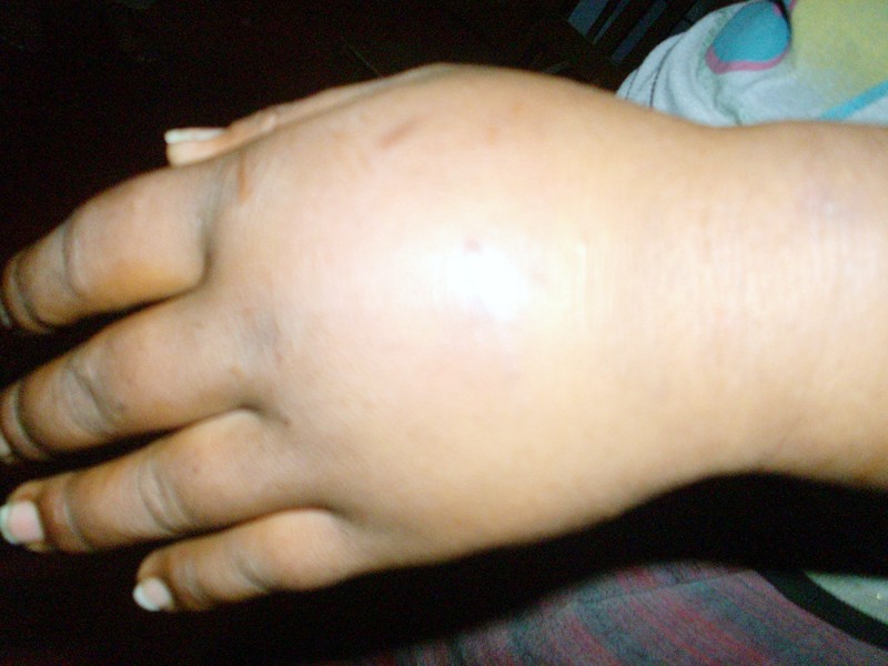 With hands that have seen many an abuse from her former employers, Meena wants to start shaping a new life for herself.
